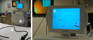 Image: The Olympus ScopeGuide system: Adult variable-stiffness colonoscope with embedded sensors CF-Q160DL (A), EM transmitter (B), system monitor (C), (Photo courtesy of Olympus).